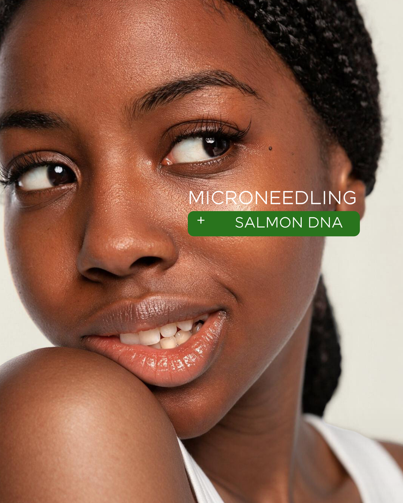 Microneedling Face x Salmon DNA