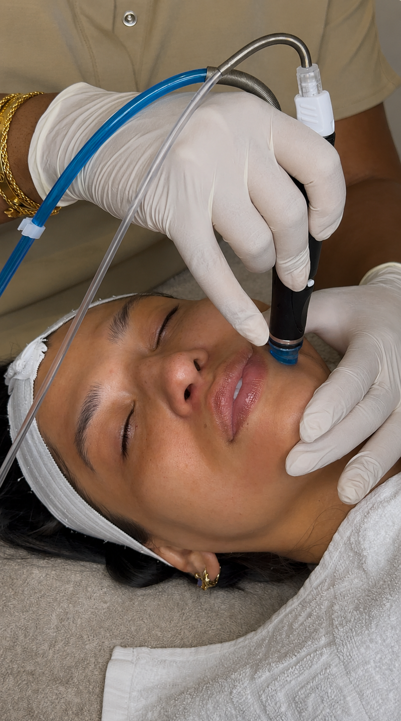 Vitamin C Hydrafacial