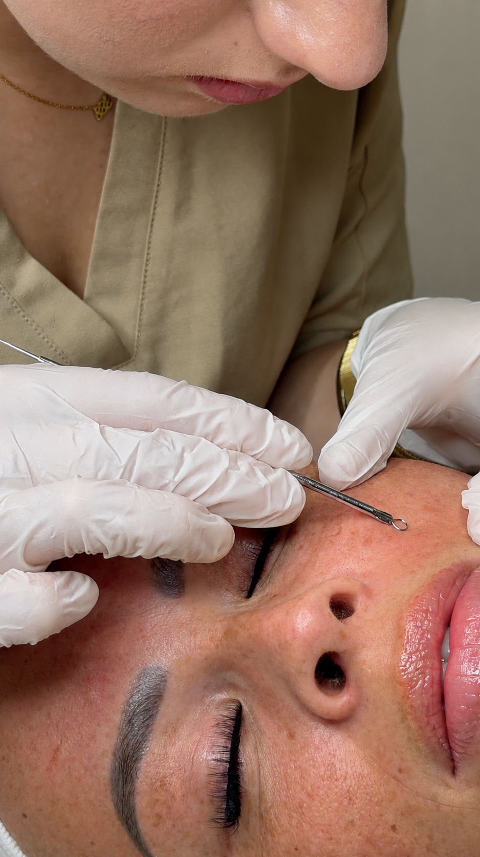 Why a healthy skin barrier is essential