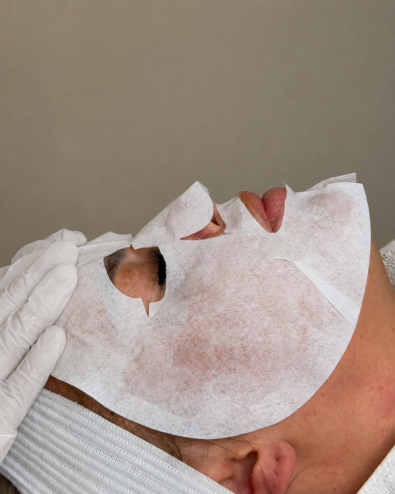 CO2 Carboxy Therapy