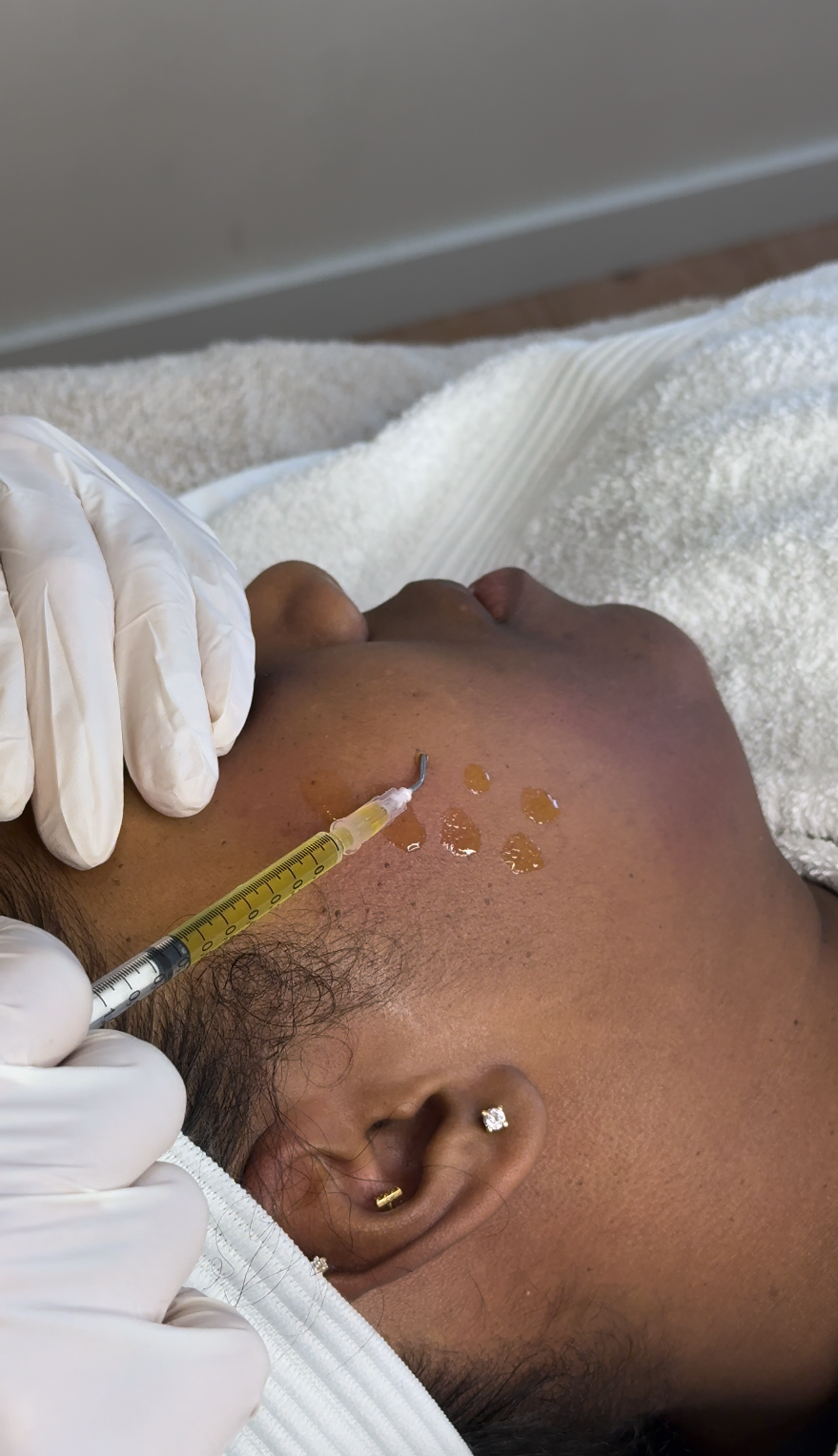 Intensieve pigmentcorrectie voor een helderdere, egalere huid.