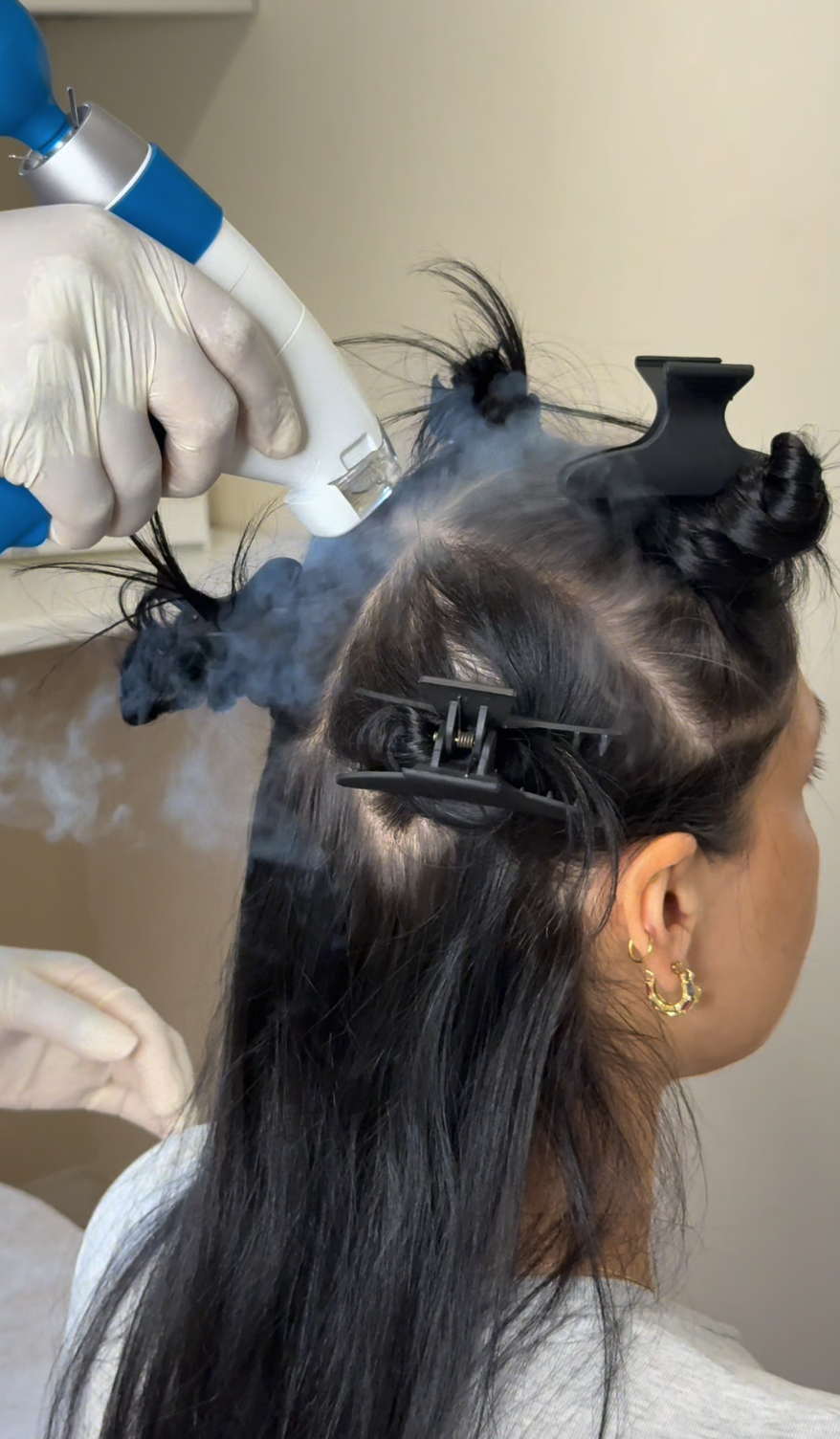 Your scalp, understood.