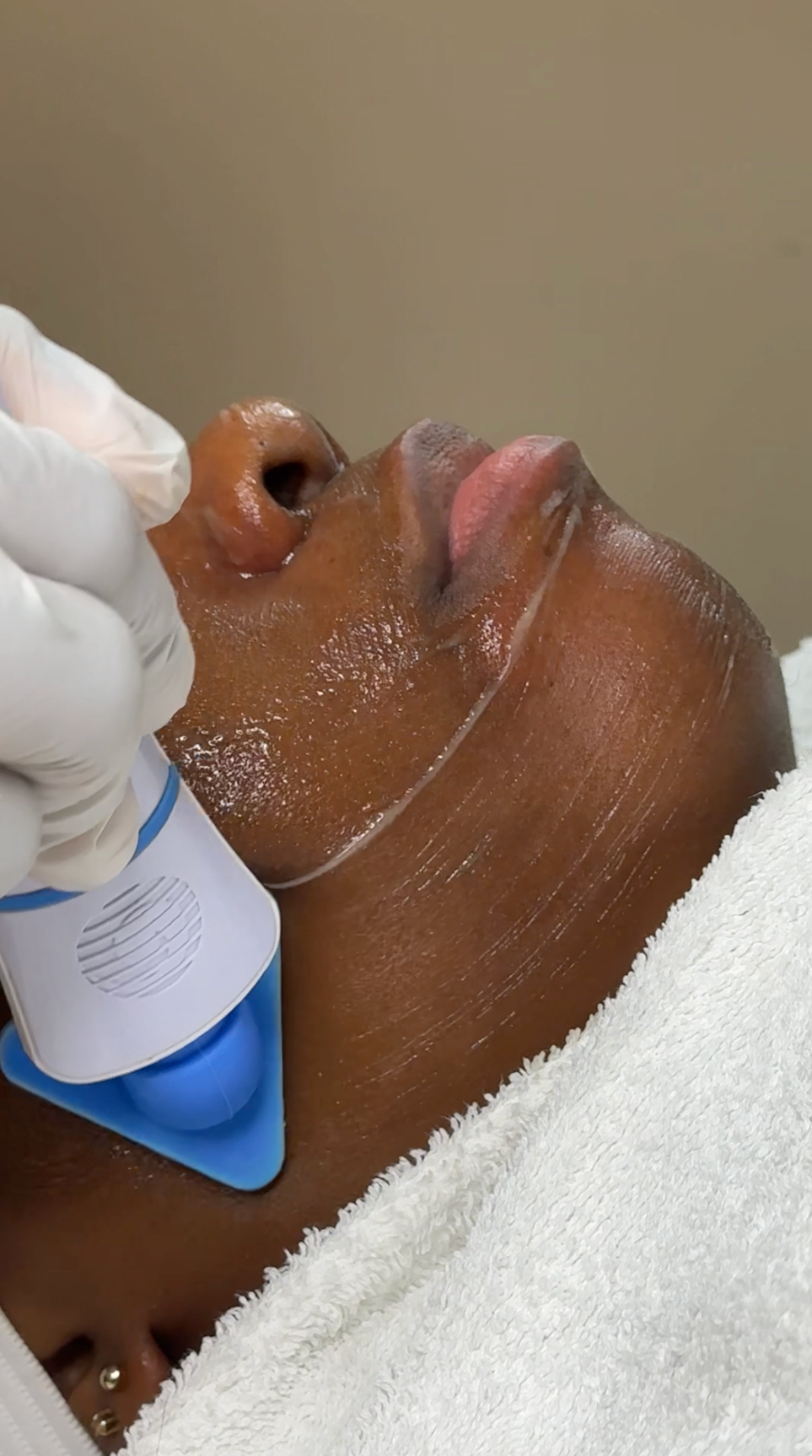 Intensieve retinol reset voor huidvernieuwing.