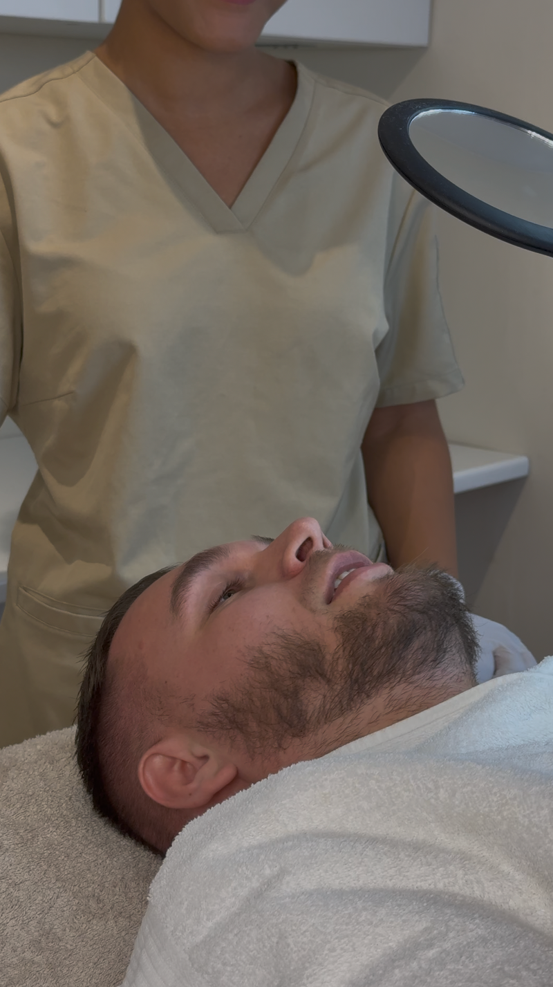 Microneedling Beard