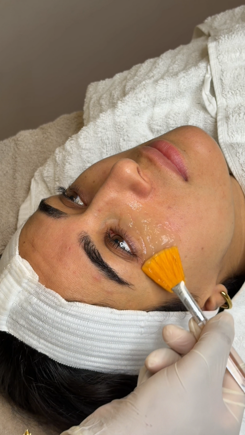 CO2 Carboxy Therapy Eyes